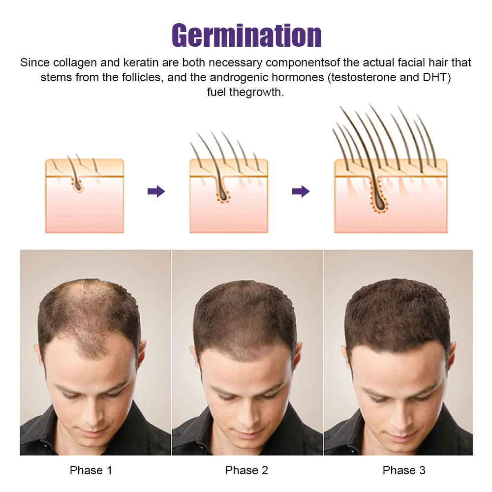 Derma Roller Micro needling